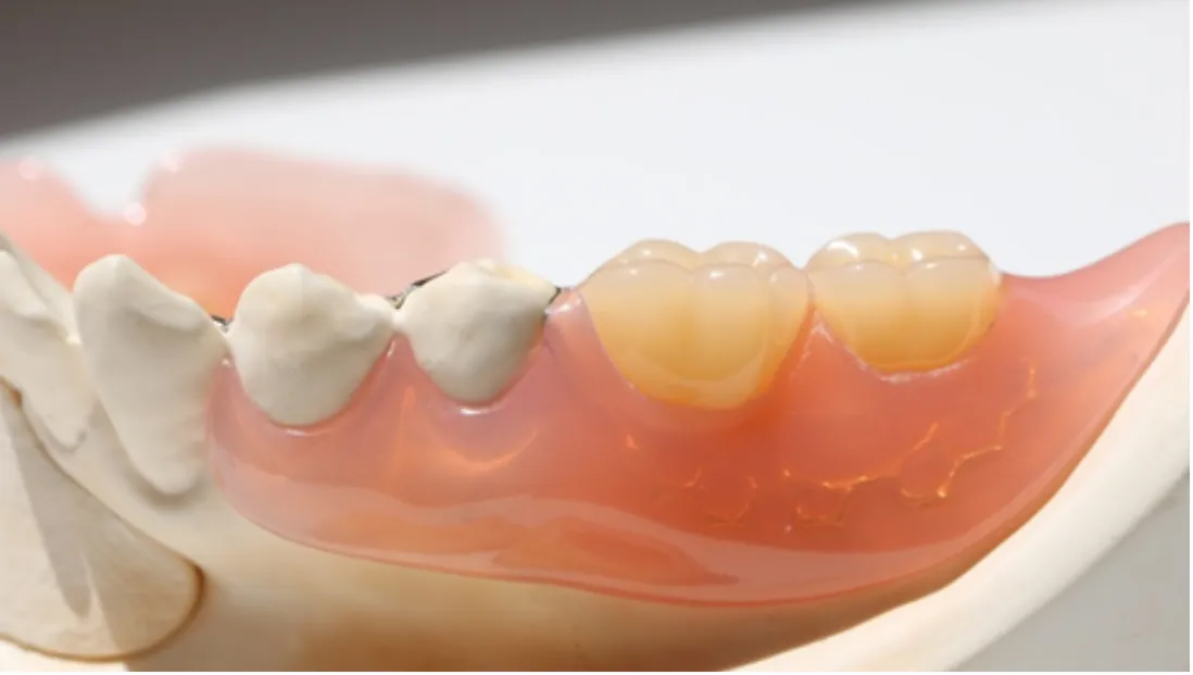 自由診療|池袋の歯医者・歯科「Lily Smile Dental Clinic」