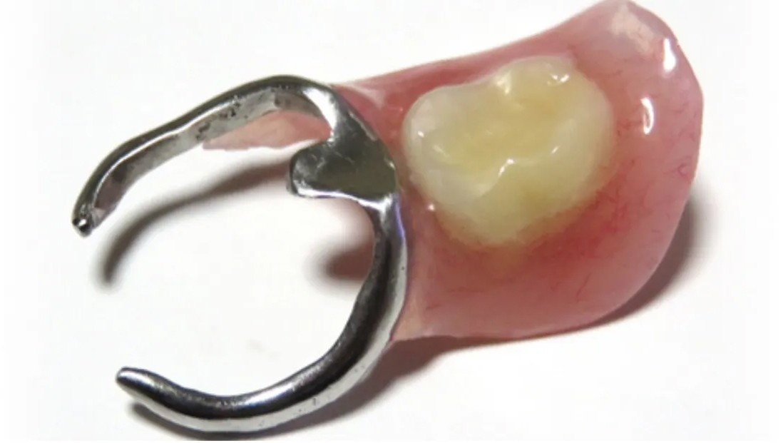 保険診療|池袋の歯医者・歯科「Lily Smile Dental Clinic」