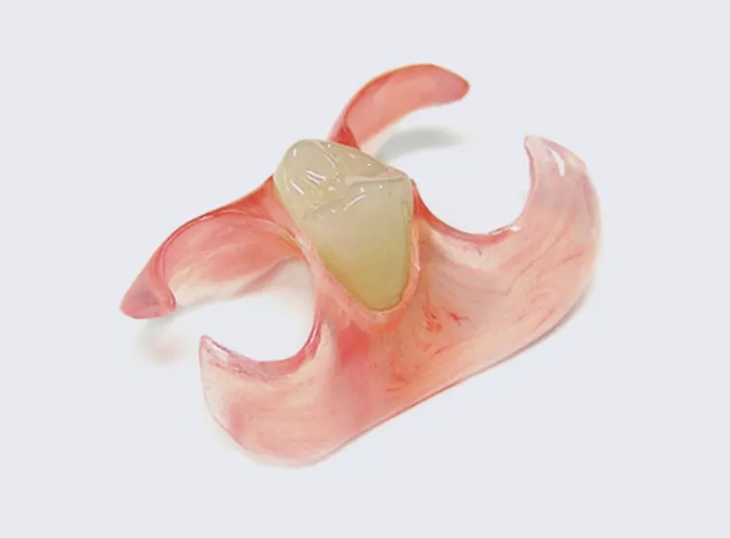 スマイルデンチャー|池袋の歯医者・歯科「Lily Smile Dental Clinic」