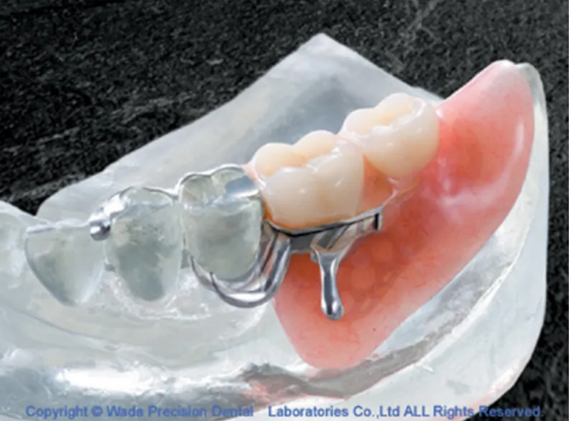 カムデンチャー|池袋の歯医者・歯科「Lily Smile Dental Clinic」
