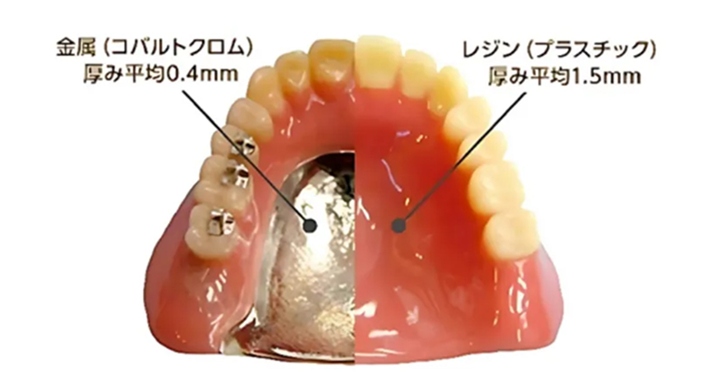 金属床義歯(コバルトクロム義歯)|池袋の歯医者・歯科「Lily Smile Dental Clinic」
