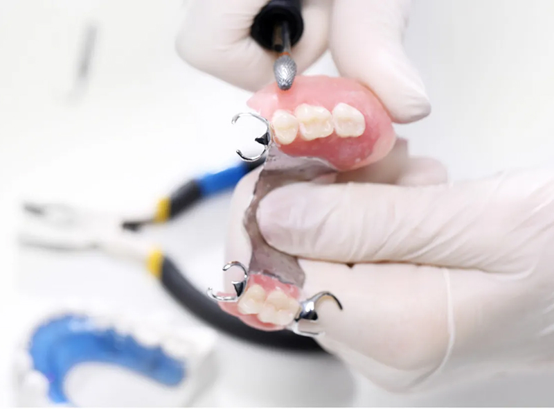 修理・増歯・リライニング(再裏装)・リベース|池袋の歯医者・歯科「Lily Smile Dental Clinic」