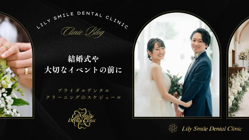 結婚式や大切なイベントの前に｜ブライダルデンタル・クリーニングのスケジュール