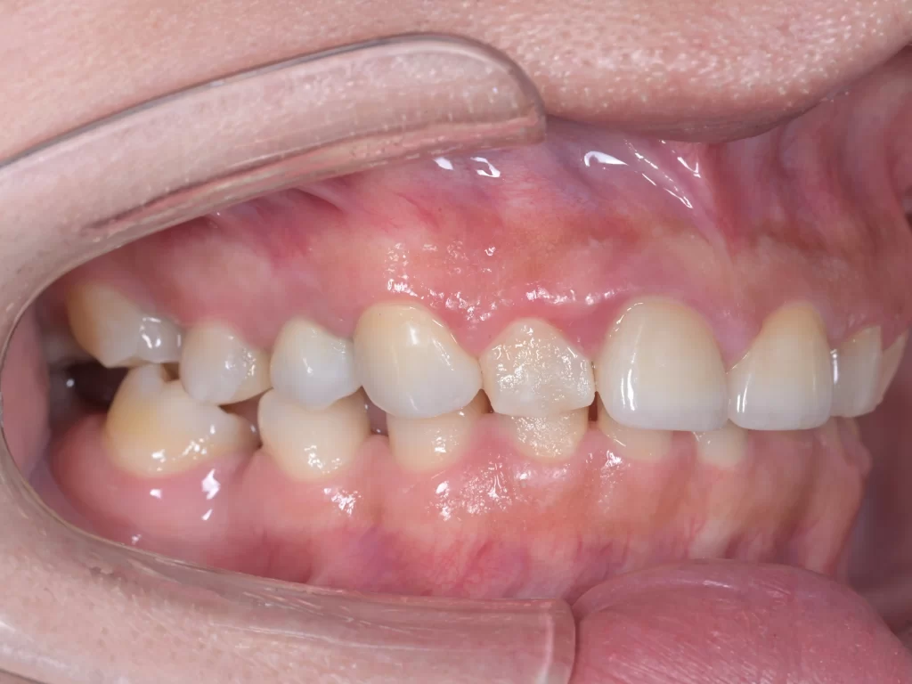 after①|池袋の歯医者・歯科「Lily Smile Dental Clinic」